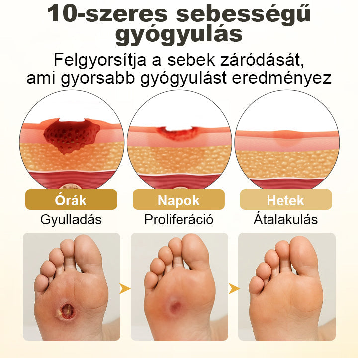 CleraNaure® GlucaVeil 24H Lábvédő Spray 🌿 – Természetes Védőformula Érzékeny és Száraz Láb Bőrének Mindennapi Ápolására 🎁
