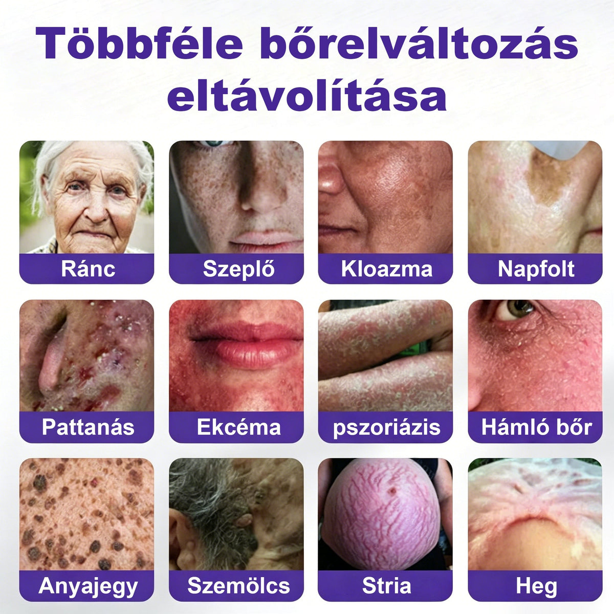 CleraNaure® mikrotűs szemölcs- és anyajegyeltávolító tapasz🎁