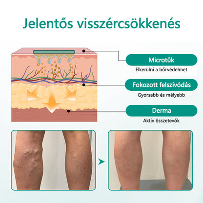 🥇CleraNaure® LegRenew Visszértágulat Párna