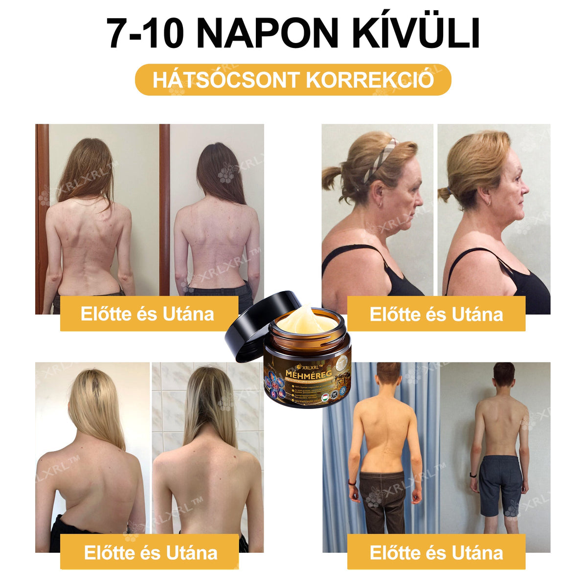 🦵XRLXRL® Méhméreg Azonnali Ultra Erős Fájdalomcsillapító Krém - (Enyhíti a fájdalmat ízületi gyulladás, izomfájdalom, hátfájás, térdek, hát, vállak, csípők, csuklók, kezek esetén)📦