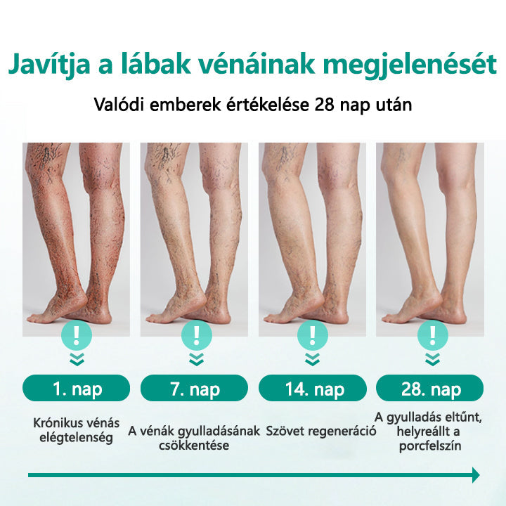 🥇CleraNaure® LegRenew Visszértágulat Párna