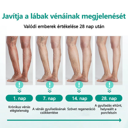 🥇CleraNaure® LegRenew Visszértágulat Párna