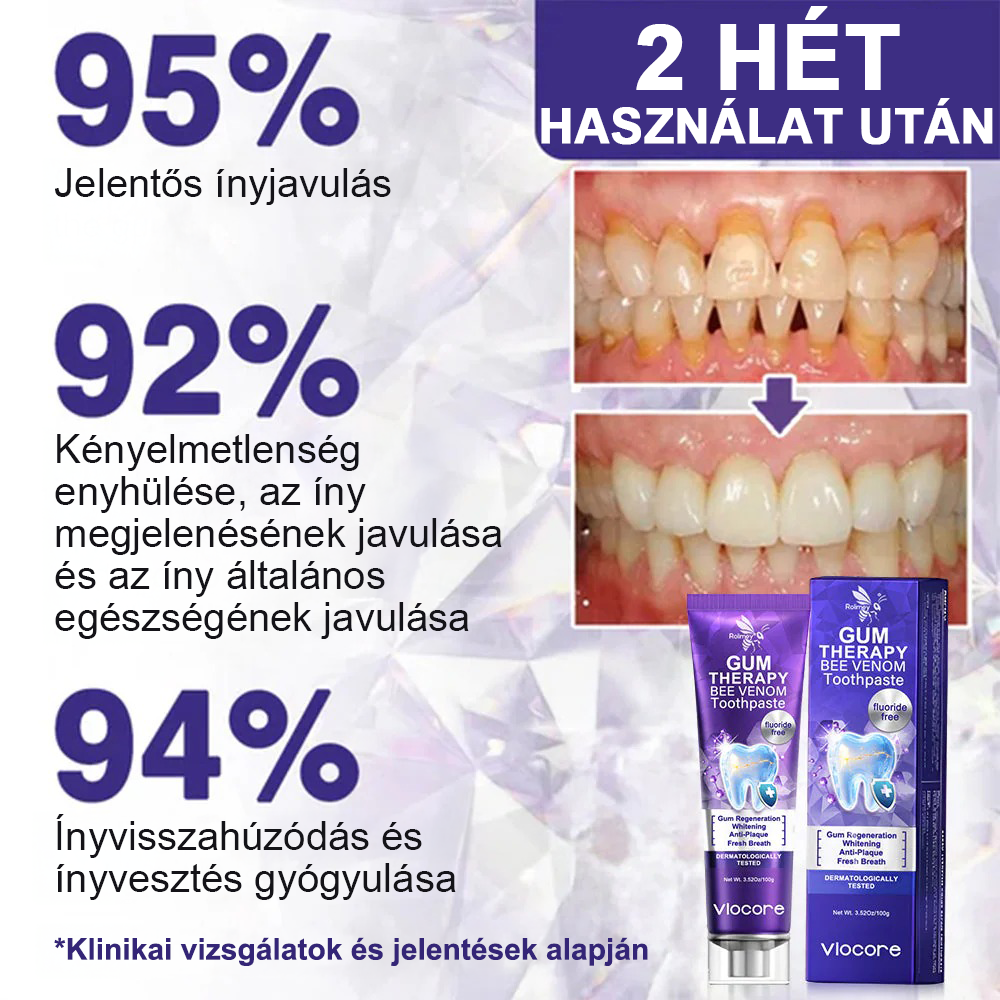 🌟Rolimey® VioCore Méhméreg Fogkezelő Fogkrém💥