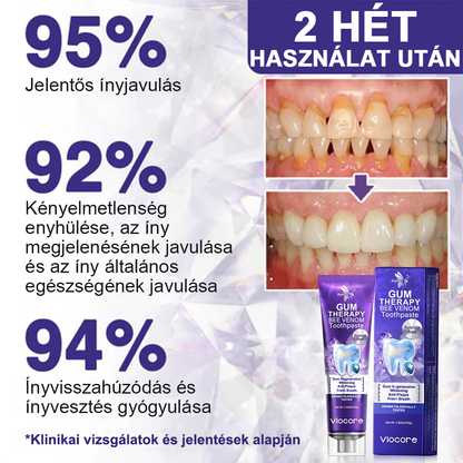 🌟Rolimey® VioCore Méhméreg Fogkezelő Fogkrém💥