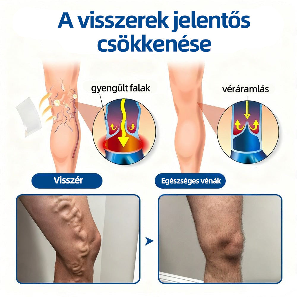 🇭🇺𝐇𝐞𝐚𝐥𝐫𝐢𝐳𝐞® 👩‍⚕️VeinTarget mikrotűs tapasz⚡☑️Azonnali enyhülés hosszú távú eredmények📦