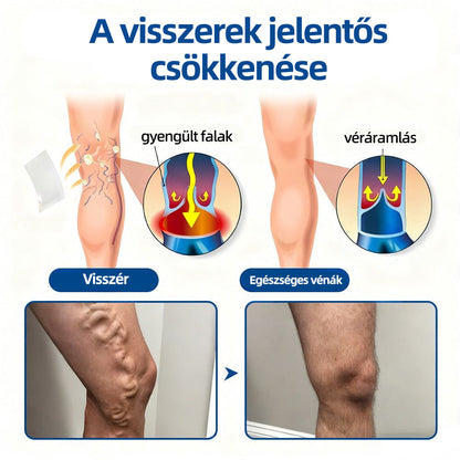 🇭🇺𝐇𝐞𝐚𝐥𝐫𝐢𝐳𝐞® 👩‍⚕️VeinTarget mikrotűs tapasz⚡☑️Azonnali enyhülés hosszú távú eredmények📦