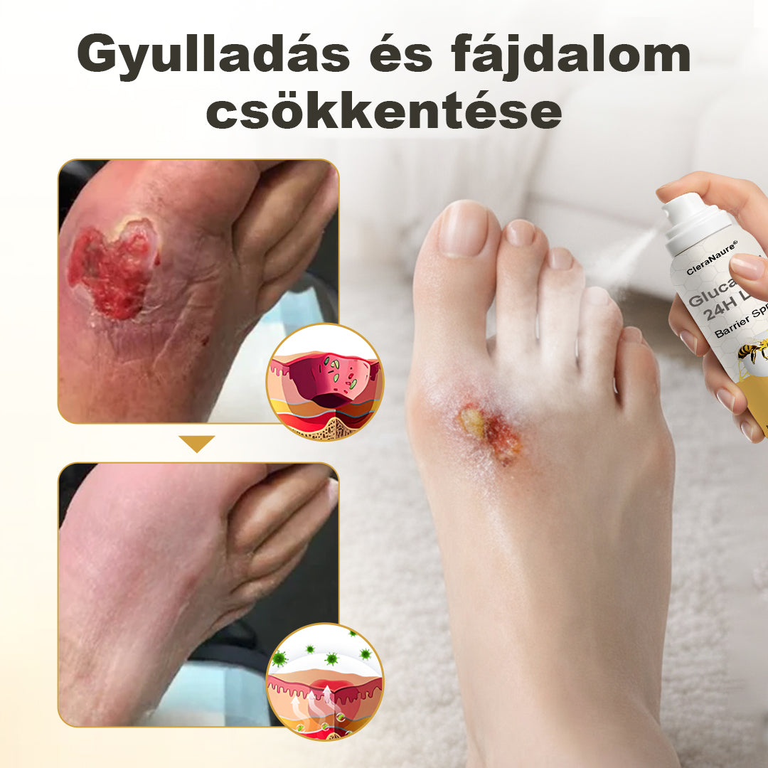 CleraNaure® GlucaVeil 24H Lábvédő Spray 🌿 – Természetes Védőformula Érzékeny és Száraz Láb Bőrének Mindennapi Ápolására 🎁
