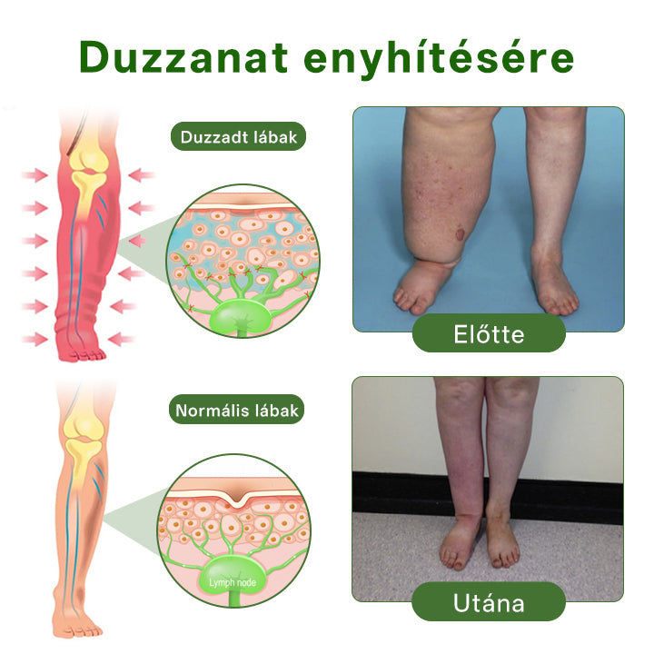 🌿Buzora® professzionális lábápoló krém💥