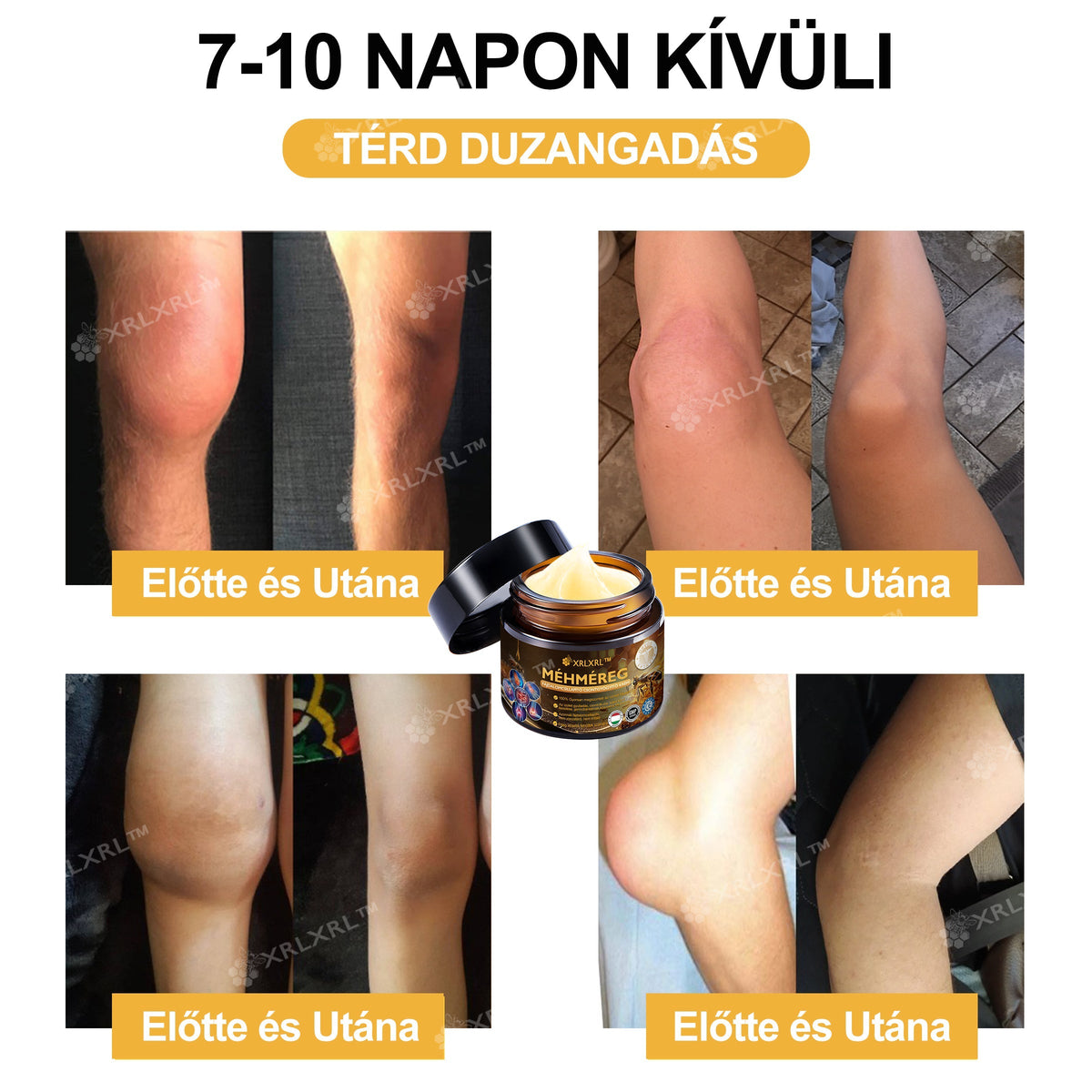 🦵XRLXRL® Méhméreg Azonnali Ultra Erős Fájdalomcsillapító Krém - (Enyhíti a fájdalmat ízületi gyulladás, izomfájdalom, hátfájás, térdek, hát, vállak, csípők, csuklók, kezek esetén)📦