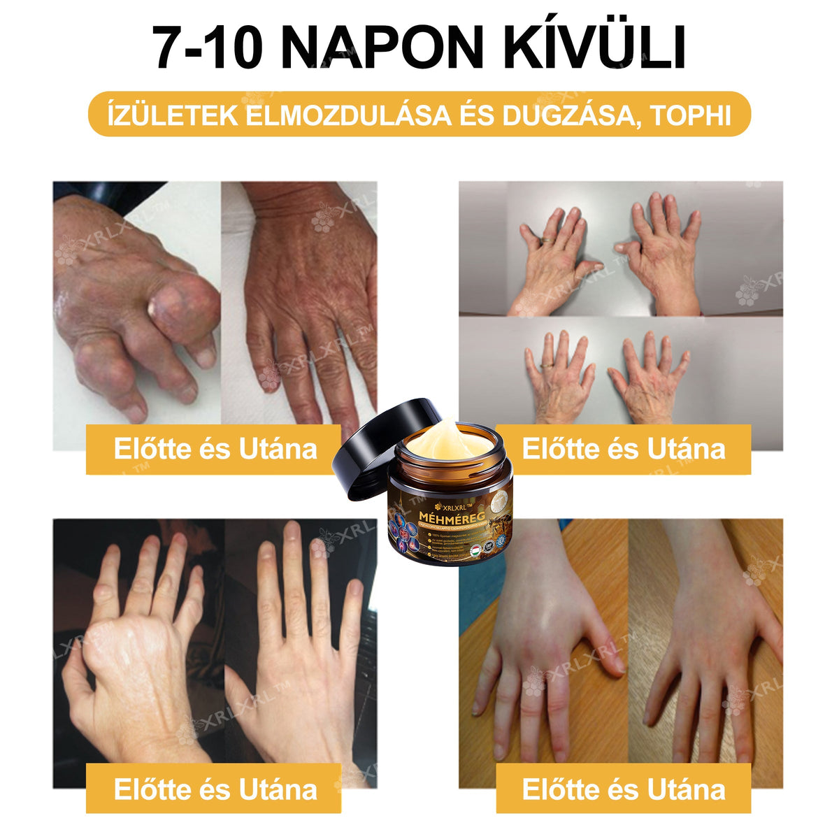 🦵XRLXRL® Méhméreg Azonnali Ultra Erős Fájdalomcsillapító Krém - (Enyhíti a fájdalmat ízületi gyulladás, izomfájdalom, hátfájás, térdek, hát, vállak, csípők, csuklók, kezek esetén)📦