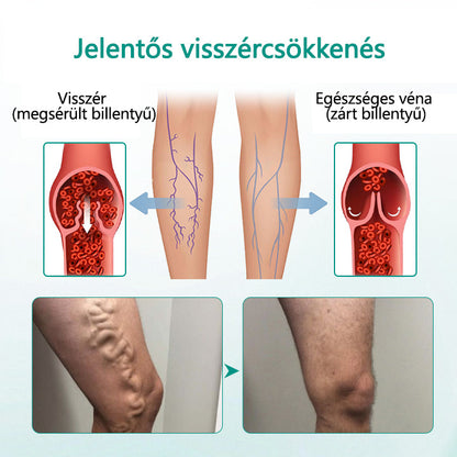 🥇CleraNaure® LegRenew Visszértágulat Párna