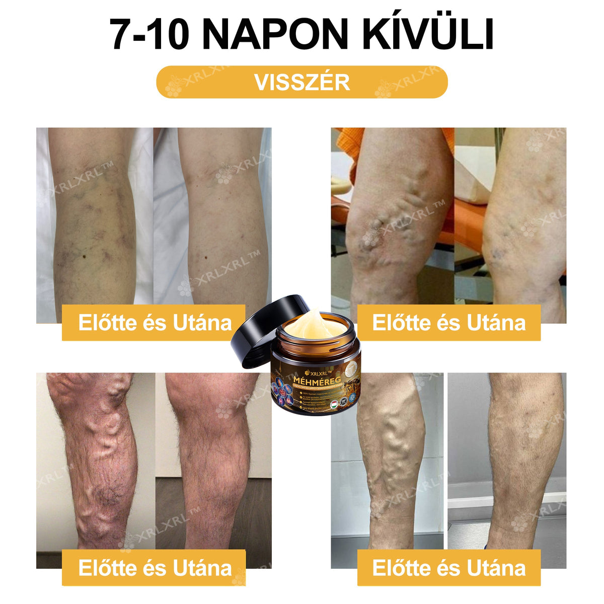 🦵XRLXRL® Méhméreg Azonnali Ultra Erős Fájdalomcsillapító Krém - (Enyhíti a fájdalmat ízületi gyulladás, izomfájdalom, hátfájás, térdek, hát, vállak, csípők, csuklók, kezek esetén)📦