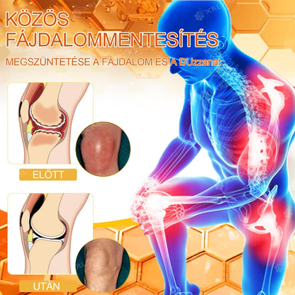 🦵XRLXRL® Méhméreg Azonnali Ultra Erős Fájdalomcsillapító Krém - (Enyhíti a fájdalmat ízületi gyulladás, izomfájdalom, hátfájás, térdek, hát, vállak, csípők, csuklók, kezek esetén)📦
