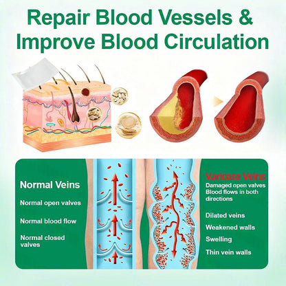 👨‍⚕️🦵✅Healrize® VeinTarget mikrotűs tapasz ⚡Azonnali enyhülés hosszú távú eredmények
