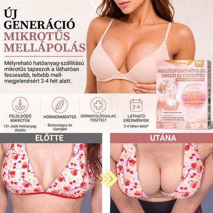 💫HISKIN® MELLEMELŐ ÉS FESZESÍTŐ MIKROTŰS TAPASZOK🎁