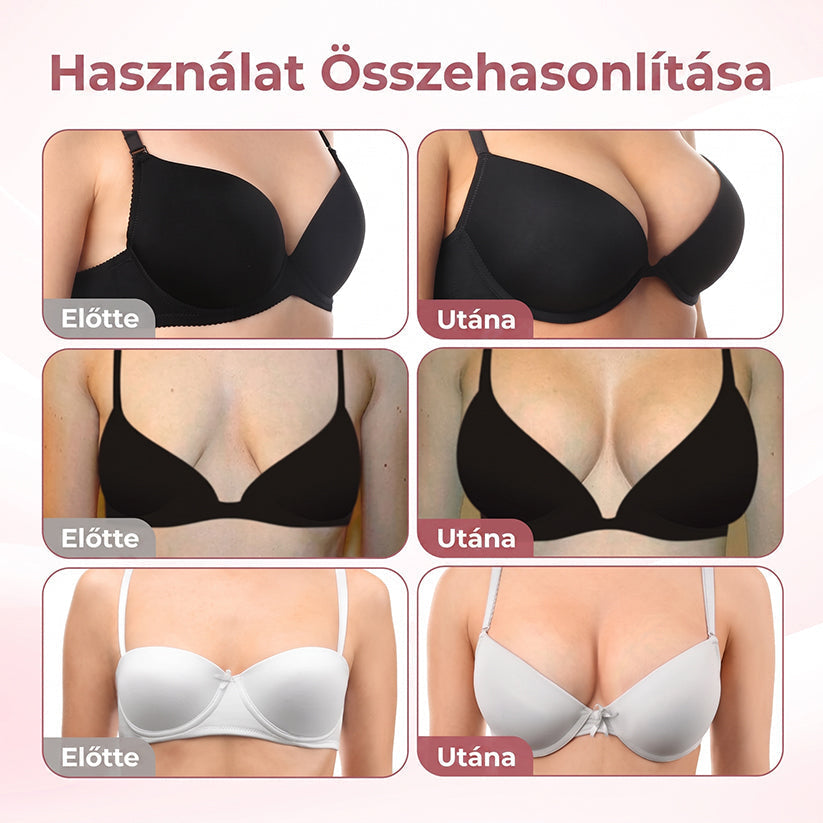 💫HISKIN® MELLEMELŐ ÉS FESZESÍTŐ MIKROTŰS TAPASZOK🎁
