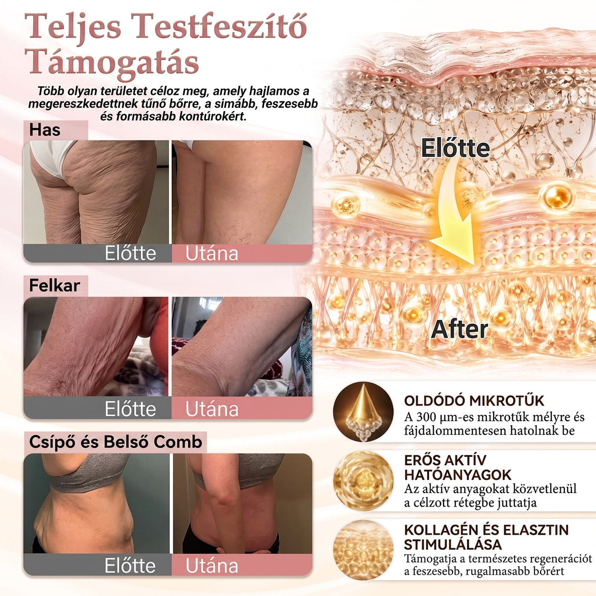 💫HISKIN® MELLEMELŐ ÉS FESZESÍTŐ MIKROTŰS TAPASZOK🎁