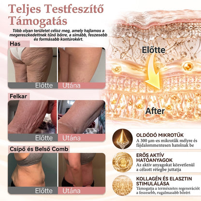 💫HISKIN® MELLEMELŐ ÉS FESZESÍTŐ MIKROTŰS TAPASZOK🎁