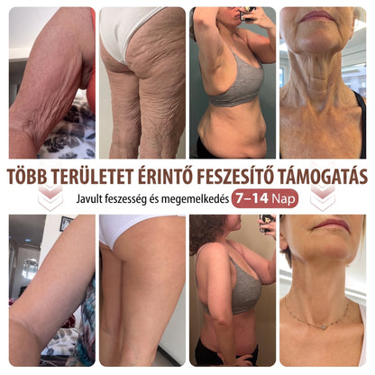 💫HISKIN® MELLEMELŐ ÉS FESZESÍTŐ MIKROTŰS TAPASZOK🎁
